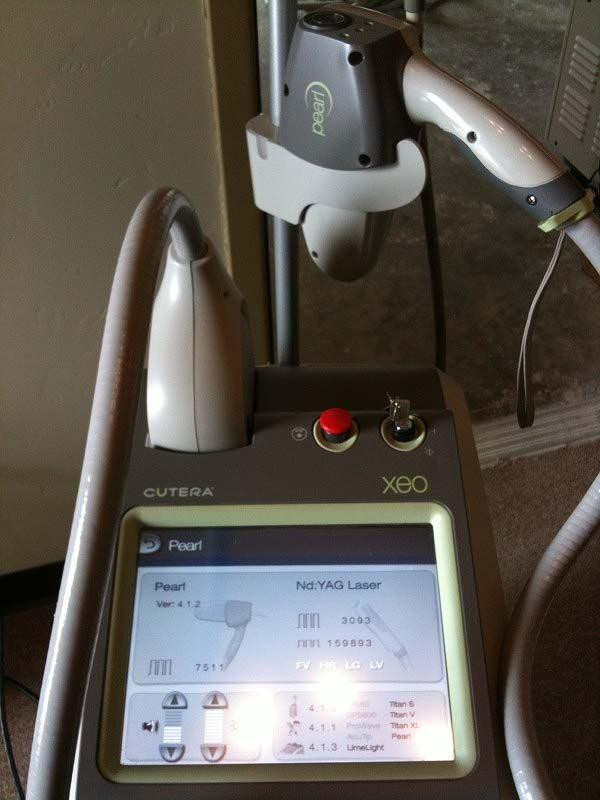 2009 Aestethic Laser - Cutera XEO with Navigation Module - LEASE to OWN $1300 per month in Health & Special Needs