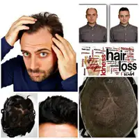 Toupee, Wigs, Men Hair Replacement, Hair System,  Hair Extensions