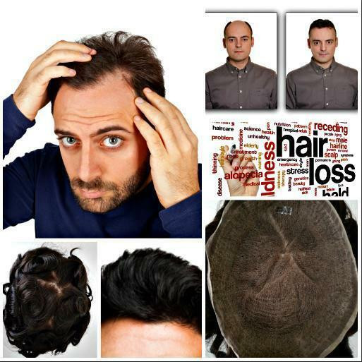 Toupee, Wigs, Men Hair Replacement, Hair System,  Hair Extensions in Health & Special Needs