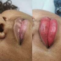 dark lips , lip neutralization , Tattoo, Permanent lipstick, lipstick, lip shading, permanent makeup, lip tattoo